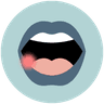 Canker Sores